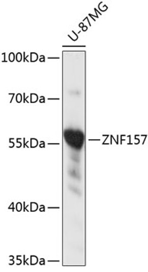 Western blot analysis of lysates from U-87MG cells, using ZNF157 Rabbit pAb (STJ116535) at 1:3000 dilution. <br/>Secondary antibody: HRP-conjugated Goat anti-Rabbit IgG (H+L) (STJS000856) at 1:10000 dilution. <br/>Lysates/proteins: 25 Mu g per lane. <br/>Blocking buffer: 3% nonfat dry milk in TBST. <br/>Detection: ECL Basic Kit <br/>Exposure time: 1s.