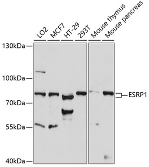 Western blot analysis of various lysates using ESRP1 Rabbit polyclonal antibody (STJ116833) at 1:1000 dilution. Secondary antibody: HRP Goat Anti-Rabbit IgG (H+L) (STJS000856) at 1:10000 dilution. Lysates/proteins: 25 Mu g per lane. Blocking buffer: 3% nonfat dry milk in TBST. Detection: ECL Basic Kit. Exposure time: 30s.