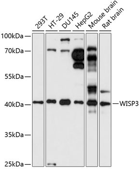 Western blot analysis of various lysates using WISP3 Rabbit polyclonal antibody (STJ117012) at 1:1000 dilution. Secondary antibody: HRP Goat Anti-Rabbit IgG (H+L) (STJS000856) at 1:10000 dilution. Lysates/proteins: 25 Mu g per lane. Blocking buffer: 3% nonfat dry milk in TBST. Detection: ECL Basic Kit. Exposure time: 30s.