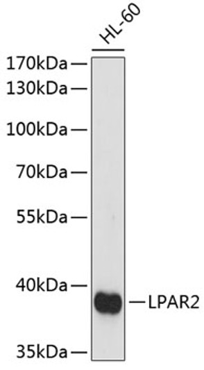 Western blot analysis of lysates from HL-60 cells, using LPAR2 Rabbit polyclonal antibody (STJ117019) at 1:1000 dilution. Secondary antibody: HRP Goat Anti-Rabbit IgG (H+L) (STJS000856) at 1:10000 dilution. Lysates/proteins: 25 Mu g per lane. Blocking buffer: 3% nonfat dry milk in TBST. Detection: ECL Basic Kit. Exposure time: 90s.
