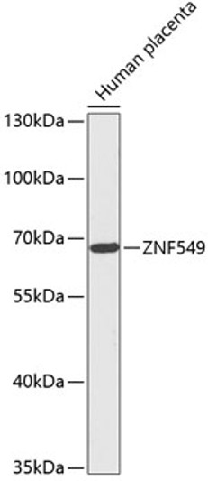 Western blot analysis of lysates from Human placenta, using ZNF549 Rabbit pAb (STJ117178) at 1:1000 dilution. <br/>Secondary antibody: HRP-conjugated Goat anti-Rabbit IgG (H+L) (STJS000856) at 1:10000 dilution. <br/>Lysates/proteins: 25 Mu g per lane. <br/>Blocking buffer: 3% nonfat dry milk in TBST. <br/>Detection: ECL Basic Kit <br/>Exposure time: 90s.