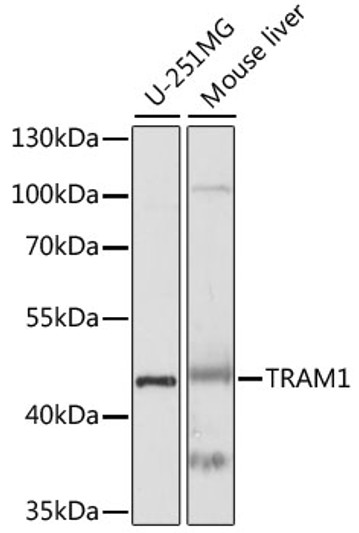Western blot analysis of various lysates using TRAM1 Rabbit polyclonal antibody (STJ117336) at 1:1000 dilution. Secondary antibody: HRP Goat Anti-Rabbit IgG (H+L) (STJS000856) at 1:10000 dilution. Lysates/proteins: 25 Mu g per lane. Blocking buffer: 3% nonfat dry milk in TBST. Detection: ECL Basic Kit. Exposure time: 10s.