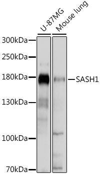 Western blot analysis of various lysates using SASH1 Rabbit polyclonal antibody (STJ117442) at 1:1000 dilution. Secondary antibody: HRP Goat Anti-Rabbit IgG (H+L) (STJS000856) at 1:10000 dilution. Lysates/proteins: 25 Mu g per lane. Blocking buffer: 3% nonfat dry milk in TBST. Detection: ECL Basic Kit. Exposure time: 5s.