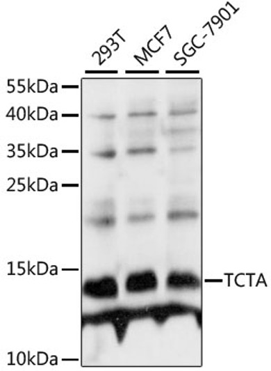 Western blot analysis of various lysates using TCTA Rabbit polyclonal antibody (STJ117517) at 1:1000 dilution. Secondary antibody: HRP Goat Anti-Rabbit IgG (H+L) (STJS000856) at 1:10000 dilution. Lysates/proteins: 25 Mu g per lane. Blocking buffer: 3% nonfat dry milk in TBST. Detection: ECL Basic Kit. Exposure time: 3s.