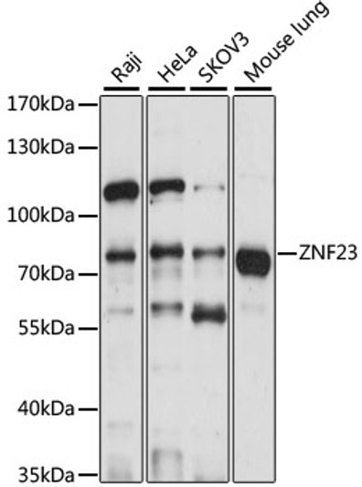 Western blot analysis of various lysates using ZNF23 Rabbit polyclonal antibody (STJ117524) at 1:1000 dilution. Secondary antibody: HRP Goat Anti-Rabbit IgG (H+L) (STJS000856) at 1:10000 dilution. Lysates/proteins: 25 Mu g per lane. Blocking buffer: 3% nonfat dry milk in TBST. Detection: ECL Basic Kit. Exposure time: 10s.
