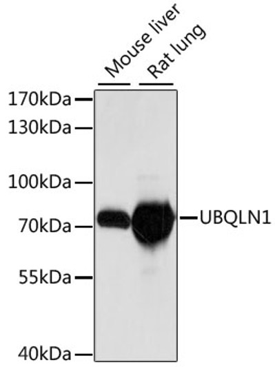 Western blot analysis of various lysates using UBQLN1 Rabbit polyclonal antibody (STJ117634) at 1:1000 dilution. Secondary antibody: HRP Goat Anti-Rabbit IgG (H+L) (STJS000856) at 1:10000 dilution. Lysates/proteins: 25 Mu g per lane. Blocking buffer: 3% nonfat dry milk in TBST. Detection: ECL Basic Kit. Exposure time: 10s.