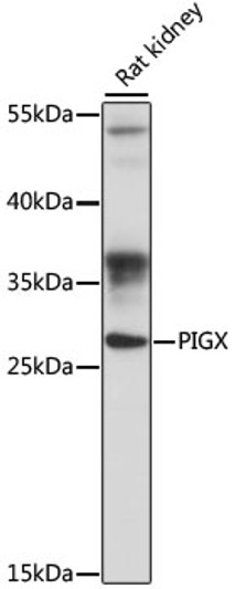 Western blot analysis of lysates from rat kidney, using PIGX Rabbit polyclonal antibody (STJ117655) at 1:1000 dilution. Secondary antibody: HRP Goat Anti-Rabbit IgG (H+L) (STJS000856) at 1:10000 dilution. Lysates/proteins: 25 Mu g per lane. Blocking buffer: 3% nonfat dry milk in TBST. Detection: ECL Basic Kit. Exposure time: 90s.