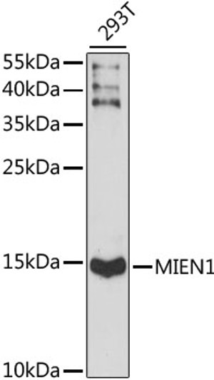 Western blot analysis of lysates from 293T cells, using MIEN1 Rabbit polyclonal antibody (STJ117730) at 1:1000 dilution. Secondary antibody: HRP Goat Anti-Rabbit IgG (H+L) (STJS000856) at 1:10000 dilution. Lysates/proteins: 25 Mu g per lane. Blocking buffer: 3% nonfat dry milk in TBST. Detection: ECL Basic Kit. Exposure time: 90s.