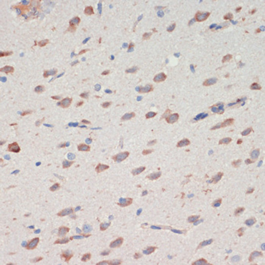 Immunohistochemistry analysis of SERPINI1 in paraffin-embedded rat brain using SERPINI1 Rabbit polyclonal antibody (STJ118149) at dilution of 1:200 (40x lens). Perform microwave antigen retrieval with 10 mM PBS buffer pH 7. 2 before commencing with immunohistochemistry staining protocol.