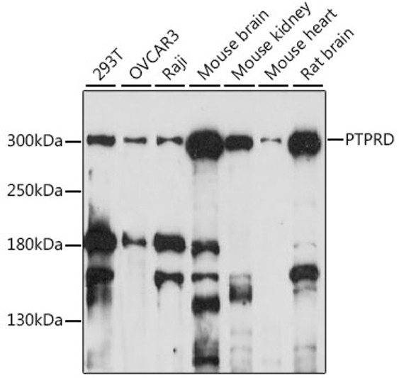 Western blot analysis of various lysates using PTPRD Rabbit polyclonal antibody (STJ118159) at 1:1000 dilution. Secondary antibody: HRP Goat Anti-Rabbit IgG (H+L) (STJS000856) at 1:10000 dilution. Lysates/proteins: 25 Mu g per lane. Blocking buffer: 3% nonfat dry milk in TBST. Detection: ECL Basic Kit. Exposure time: 3min.