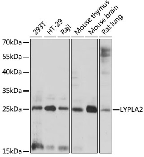 Western blot analysis of various lysates using LYPLA2 Rabbit polyclonal antibody (STJ118237) at 1:1000 dilution. Secondary antibody: HRP Goat Anti-Rabbit IgG (H+L) (STJS000856) at 1:10000 dilution. Lysates/proteins: 25 Mu g per lane. Blocking buffer: 3% nonfat dry milk in TBST. Detection: ECL Enhanced Kit. Exposure time: 90s.