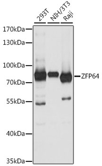Western blot analysis of various lysates using ZFP64 Rabbit polyclonal antibody (STJ118308) at 1:1000 dilution. Secondary antibody: HRP Goat Anti-Rabbit IgG (H+L) (STJS000856) at 1:10000 dilution. Lysates/proteins: 25 Mu g per lane. Blocking buffer: 3% nonfat dry milk in TBST. Detection: ECL Basic Kit. Exposure time: 10s. Western blot analysis of various lysates using ZFP64 Rabbit polyclonal antibody (STJ118308) at 1:1000 dilution. Secondary antibody: HRP Goat Anti-Rabbit IgG (H+L) (STJS000856) at 1:10000 dilution. Lysates/proteins: 25 Mu g per lane. Blocking buffer: 3% nonfat dry milk in TBST. Detection: ECL Basic Kit. Exposure time: 10s.