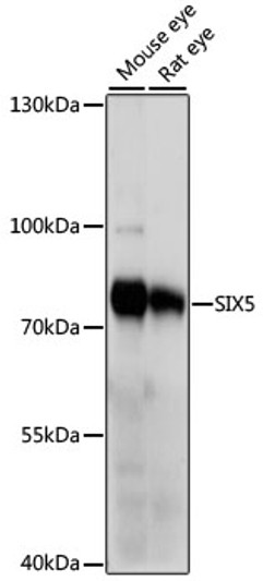 Western blot analysis of various lysates using SIX5 Rabbit polyclonal antibody (STJ118405) at 1000 dilution. Secondary antibody: HRP Goat Anti-Rabbit IgG (H+L) (STJS000856) at 1:10000 dilution. Lysates/proteins: 25 Mu g per lane. Blocking buffer: 3% nonfat dry milk in TBST. Detection: ECL Basic Kit. Exposure time: 1s.