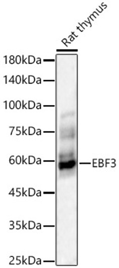 Western blot analysis of Rat thymus, using EBF3 Rabbit polyclonal antibody (STJ118418) at 1:1500 dilution. Secondary antibody: HRP Goat Anti-Rabbit IgG (H+L) (STJS000856) at 1:10000 dilution. Lysates/proteins: 25 Mu g per lane. Blocking buffer: 3% nonfat dry milk in TBST. Detection: ECL Enhanced Kit. Exposure time: 60s.