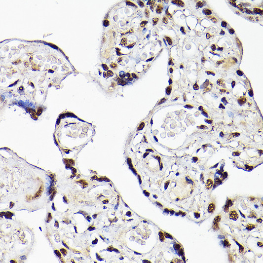 Immunohistochemistry analysis of TBX20 in paraffin-embedded human placenta using TBX20 Rabbit polyclonal antibody (STJ118439) at dilution of 1:100 (40x lens). Perform high pressure antigen retrieval with 10 mM citrate buffer pH 6. 0 before commencing with immunohistochemistry staining protocol.