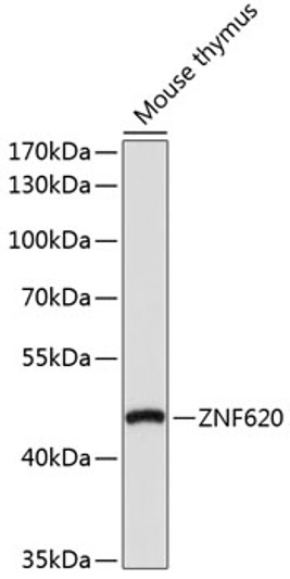 Western blot analysis of extracts of mouse thymus, using ZNF620 antibody (STJ118637) at 1:1000 dilution. Secondary antibody: HRP Goat Anti-rabbit IgG (H+L) (STJS000856) at 1:10000 dilution. Lysates/proteins: 25 Mu g per lane. Blocking buffer: 3% non-fat dry milk in TBST. Detection: ECL Basic Kit. Exposure time: 90s.