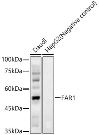 Western blot analysis of various lysates, using FAR1 Rabbit polyclonal antibody (STJ118717) at 1:2000 dilution. Secondary antibody: HRP Goat Anti-Rabbit IgG (H+L) (STJS000856) at 1:10000 dilution. Lysates/proteins: 25 Mu g per lane. Blocking buffer: 3% nonfat dry milk in TBST. Detection: ECL Basic Kit. Exposure time: 180s. Western blot analysis of various lysates, using FAR1 Rabbit polyclonal antibody (STJ118717) at 1:2000 dilution. Secondary antibody: HRP Goat Anti-Rabbit IgG (H+L) (STJS000856) at 1:10000 dilution. Lysates/proteins: 25 Mu g per lane. Blocking buffer: 3% nonfat dry milk in TBST. Detection: ECL Basic Kit. Exposure time: 180s.