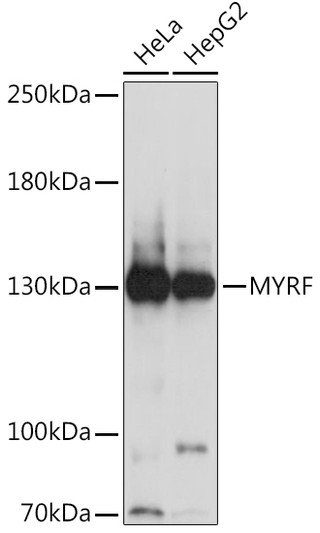 Western blot analysis of various lysates using MYRF Rabbit polyclonal antibody (STJ118783) at 1:1000 dilution. Secondary antibody: HRP Goat Anti-Rabbit IgG (H+L) (STJS000856) at 1:10000 dilution. Lysates/proteins: 25 Mu g per lane. Blocking buffer: 3% nonfat dry milk in TBST. Detection: ECL Basic Kit. Exposure time: 5s.