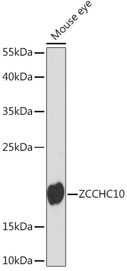 Western blot analysis of lysates from Mouse eye, using ZCCHC10 Rabbit polyclonal antibody (STJ118966) at 1:1000 dilution. Secondary antibody: HRP Goat Anti-Rabbit IgG (H+L) (STJS000856) at 1:10000 dilution. Lysates/proteins: 25 Mu g per lane. Blocking buffer: 3% nonfat dry milk in TBST. Detection: ECL Basic Kit. Exposure time: 90s.