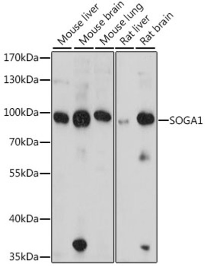 Western blot analysis of various lysates using SOGA1 Rabbit polyclonal antibody (STJ119024) at 1:1000 dilution. Secondary antibody: HRP Goat Anti-Rabbit IgG (H+L) (STJS000856) at 1:10000 dilution. Lysates/proteins: 25 Mu g per lane. Blocking buffer: 3% nonfat dry milk in TBST. Detection: ECL Basic Kit. Exposure time: 15s.