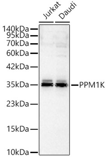 Western blot analysis of various lysates, using PPM1K rabbit polyclonal antibody (STJ119029) at 1:1000 dilution. Secondary antibody: HRP Goat Anti-rabbit IgG (H+L) (STJS000856) at 1:10000 dilution. Lysates/proteins: 25ug per lane. Blocking buffer: 3% non-fat dry milk in TBST. Detection: ECL Basic Kit. Exposure time: 60s.