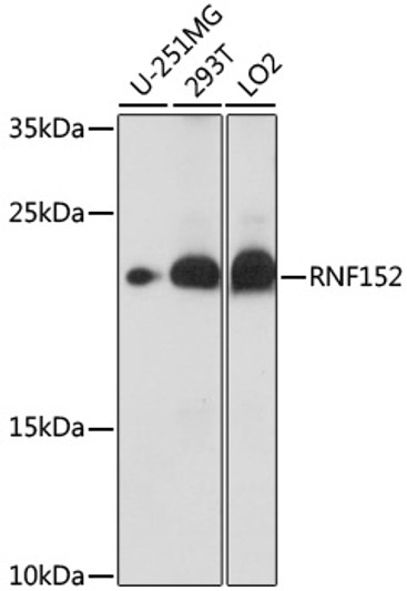 Western blot analysis of various lysates using RNF152 Rabbit polyclonal antibody (STJ119035) at 1:1000 dilution. Secondary antibody: HRP Goat Anti-Rabbit IgG (H+L) (STJS000856) at 1:10000 dilution. Lysates/proteins: 25 Mu g per lane. Blocking buffer: 3% nonfat dry milk in TBST. Detection: ECL Basic Kit. Exposure time: 10s.