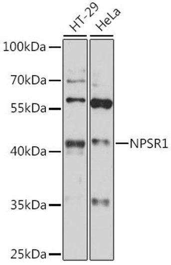 Western blot analysis of various lysates using NPSR1 Rabbit polyclonal antibody (STJ119045) at 1:1000 dilution. Secondary antibody: HRP Goat Anti-Rabbit IgG (H+L) (STJS000856) at 1:10000 dilution. Lysates/proteins: 25 Mu g per lane. Blocking buffer: 3% nonfat dry milk in TBST. Detection: ECL Enhanced Kit. Exposure time: 10s.