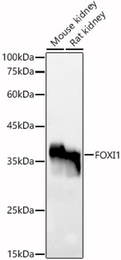 Western blot analysis of various lysates, using FOXI1 Rabbit polyclonal antibody (STJ119202) at 1:500 dilution. Secondary antibody: HRP Goat Anti-Rabbit IgG (H+L) (STJS000856) at 1:10000 dilution. Lysates/proteins: 25 Mu g per lane. Blocking buffer: 3% nonfat dry milk in TBST. Detection: ECL Basic Kit. Exposure time: 180s.