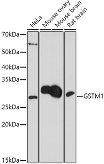 Western blot analysis of various lysates using (STJ119590) at 1:1000 dilution. Secondary antibody: HRP Goat Anti-Rabbit IgG (H+L) (STJS000856) at 1:10000 dilution. Lysates/proteins: 25 Mu g per lane. Blocking buffer: 3% nonfat dry milk in TBST. Detection: ECL Basic Kit. Exposure time: 180s.
