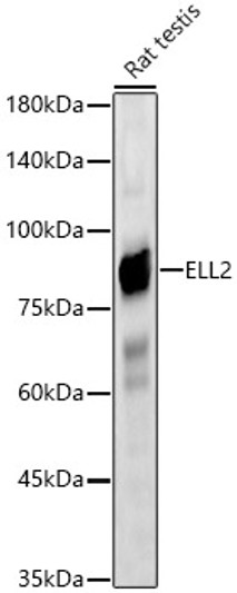 Western blot analysis of Rat testis, using ELL2 Rabbit polyclonal antibody (STJ119700) at 1:1000 dilution. Secondary antibody: HRP Goat Anti-Rabbit IgG (H+L) (STJS000856) at 1:10000 dilution. Lysates/proteins: 25 Mu g per lane. Blocking buffer: 3% nonfat dry milk in TBST. Detection: ECL Basic Kit. Exposure time: 30s.