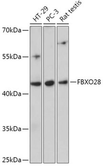 Western blot analysis of various lysates using FBXO28 Rabbit polyclonal antibody (STJ119712) at 1:1000 dilution. Secondary antibody: HRP Goat Anti-Rabbit IgG (H+L) (STJS000856) at 1:10000 dilution. Lysates/proteins: 25 Mu g per lane. Blocking buffer: 3% nonfat dry milk in TBST. Detection: ECL Basic Kit. Exposure time: 60s.