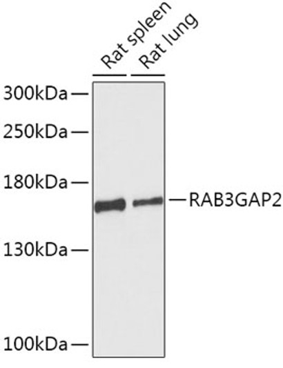 Western blot analysis of various lysates using RAB3GAP2 Rabbit polyclonal antibody (STJ119718) at 1:1000 dilution. Secondary antibody: HRP Goat Anti-Rabbit IgG (H+L) (STJS000856) at 1:10000 dilution. Lysates/proteins: 25 Mu g per lane. Blocking buffer: 3% nonfat dry milk in TBST. Detection: ECL Basic Kit. Exposure time: 90s.