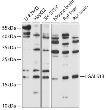 Western blot analysis of various lysates using LGALS13 Rabbit polyclonal antibody (STJ119734) at 1:1000 dilution. Secondary antibody: HRP Goat Anti-Rabbit IgG (H+L) (STJS000856) at 1:10000 dilution. Lysates/proteins: 25 Mu g per lane. Blocking buffer: 3% nonfat dry milk in TBST. Detection: ECL Basic Kit. Exposure time: 180s.