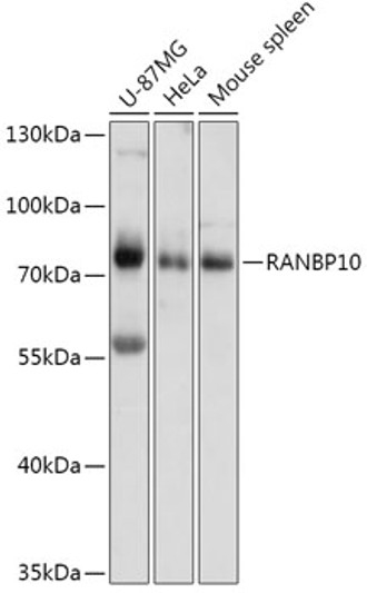 Western blot analysis of various lysates using RANBP10 Rabbit polyclonal antibody (STJ119783) at 1:1000 dilution. Secondary antibody: HRP Goat Anti-Rabbit IgG (H+L) (STJS000856) at 1:10000 dilution. Lysates/proteins: 25 Mu g per lane. Blocking buffer: 3% nonfat dry milk in TBST. Detection: ECL Basic Kit. Exposure time: 10s.