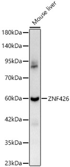 Western blot analysis of Mouse liver, using ZNF426 Rabbit polyclonal antibody (STJ119801) at 1:400 dilution. Secondary antibody: HRP Goat Anti-Rabbit IgG (H+L) (STJS000856) at 1:10000 dilution. Lysates/proteins: 25ug per lane. Blocking buffer: 3% nonfat dry milk in TBST. Detection: ECL Basic Kit. Exposure time: 60s.