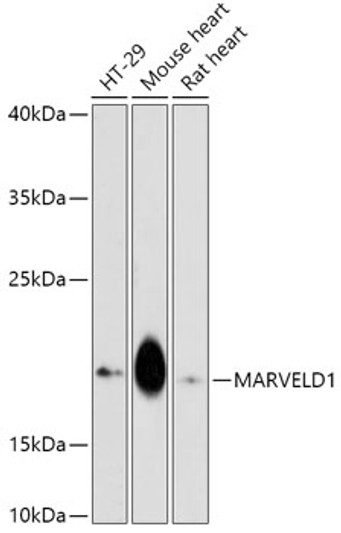 Western blot analysis of various lysates using MARVELD1 Rabbit polyclonal antibody (STJ119818) at 1:1000 dilution. Secondary antibody: HRP Goat Anti-Rabbit IgG (H+L) (STJS000856) at 1:10000 dilution. Lysates/proteins: 25 Mu g per lane. Blocking buffer: 3% nonfat dry milk in TBST. Detection: ECL Enhanced Kit. Exposure time: 300s.