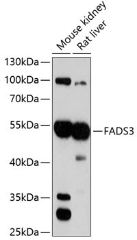 Western blot analysis of various lysates using FADS3 Rabbit polyclonal antibody (STJ23613) at 1:3000 dilution. Secondary antibody: HRP Goat Anti-Rabbit IgG (H+L) (STJS000856) at 1:10000 dilution. Lysates/proteins: 25 Mu g per lane. Blocking buffer: 3% nonfat dry milk in TBST. Detection: ECL Basic Kit. Exposure time: 90s.