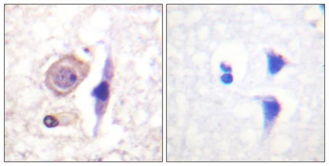 Anti-IFNGR1 antibody STJ93645