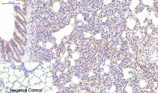Anti-Active Caspase-3 antibody STJ97448