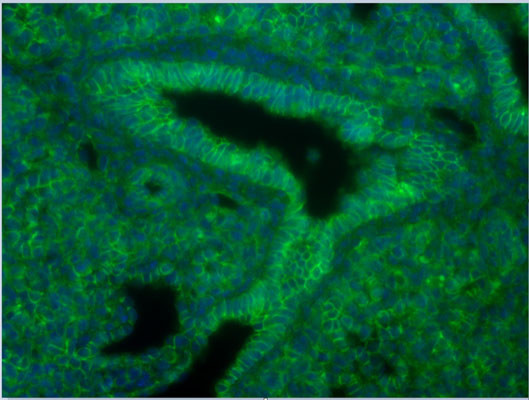 Anti-Beta Catenin antibody IHC staining mouse lung