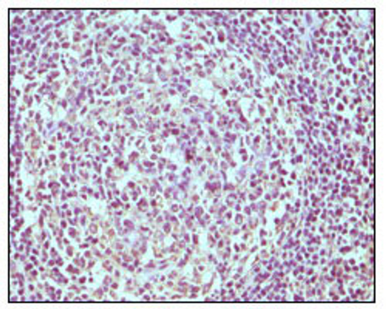 Mouse monoclonal antibody anti-B-Lymphocyte antigen Cd19