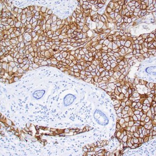 Rabbit monoclonal antibodies, IHC-P