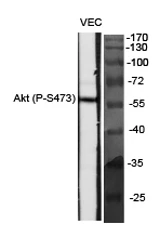 Phospho-Akt Ser473 antibody western blot STJ90166