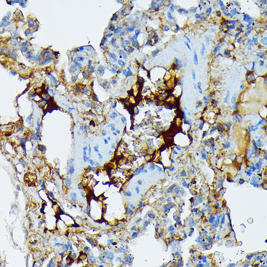 Anti-Fibrinogen alpha chain rabbit monoclonal antibody [S3MR] - WB, IHC ...