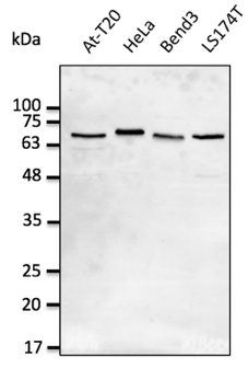 Anti-LMNA Lamin A/C antibody western blot STJ140138