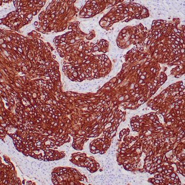 Anti-Pan-Keratin antibody AE1/AE3 IHC antibody paraffin tissue