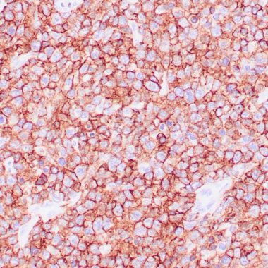 Anti-CD45/RB antibody 2B11 PD7-26 IHC antibody paraffin tissue