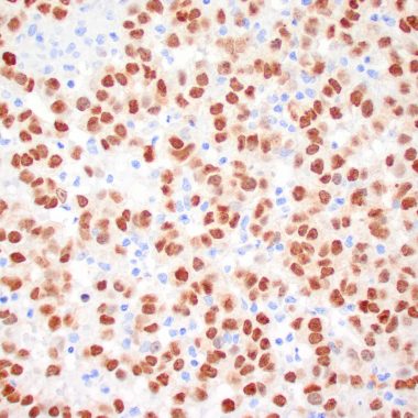Anti-MITF antibody C5/D5 IHC antibody paraffin tissue