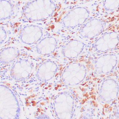 Anti-Recombinant-CD68 antibody KP1 IHC antibody paraffin tissue