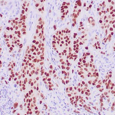Anti-GATA3 antibody L50-823 IHC antibody paraffin tissue